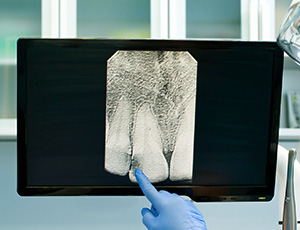 Digital x-rays on computer