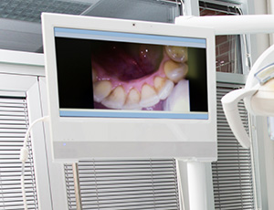 Intraoral photos on computer