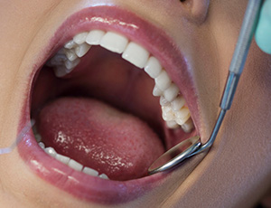 Closeup of smile duirng dental exam
