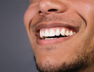 man smiling teeth