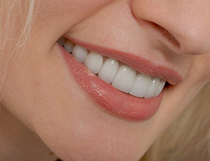 Closeup of healthy smile