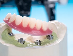 Base containing 4 dental implants and lower arch of implant dentures