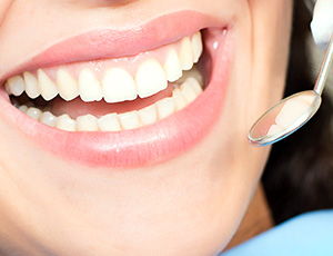 Closeup of smile during dental exam