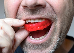 man getting dental checkup in Herndon