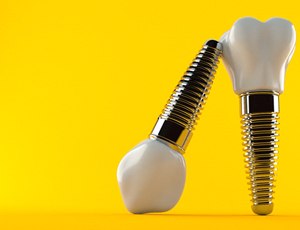 dental implants on yellow background