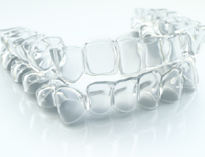 clear aligners