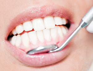 Closeup of smile during dental exam