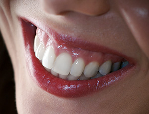 Closeup of healthy smile