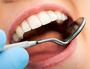 Closeup of smile during dental treatment