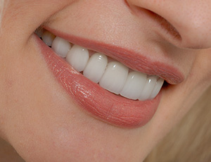 Closeup of healthy teeth and gums