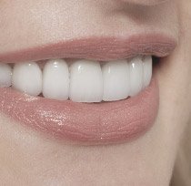 Closeup of healthy happy smile