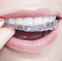 Woman placing clear aligner tray over her teeth