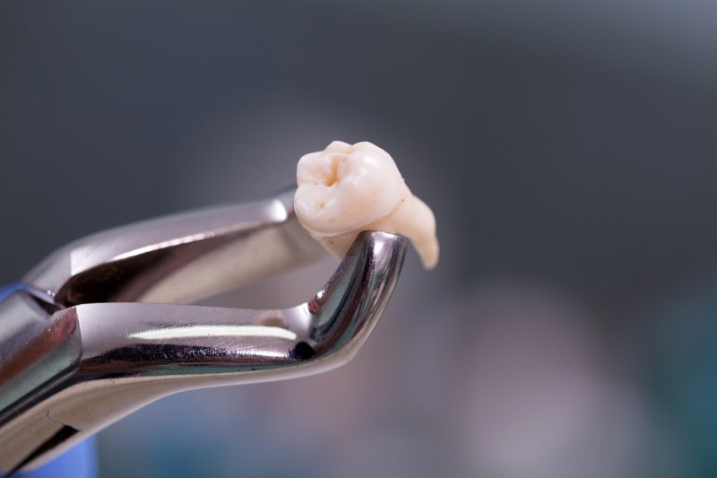 A dental instrument holding an extracted tooth