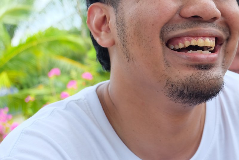 a person’s smile and discolored teeth