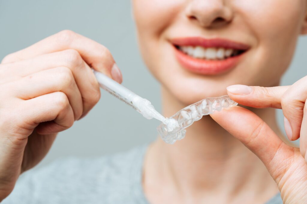 Nose-to-shoulder closeup of woman applying whitening gel to applicator tray